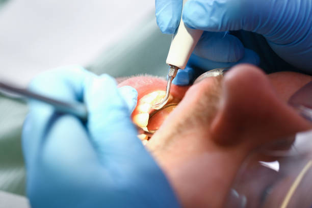 Best Emergency Broken Tooth Repair in Russell, KY